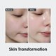 thumbnail image 5 of Ampolla facial Medi-Peel Peptide 9 Volume Bio Tox 100 ml, 5 of 5
