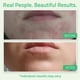 thumbnail image 4 of Exfoliante casero con ácido glicólico Peel YEOUTH, 30% AHA, 30 ml con retinol, 4 of 8