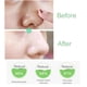thumbnail image 3 of Salicylic Acid Pore Shrinking Essence Anti-acne Exfoliating Blackhead Remover Face Spot Removal Essence Beauty Health Skin Care, 3 of 3