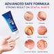 thumbnail image 3 of Crema Eliminadora De Verrugas Genitales Meoly 20 g Unisex, 3 of 3