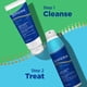 thumbnail image 4 of Spray corporal para el acné Differin 360 con ácido salicílico 180 ml, 4 of 8