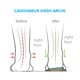 thumbnail image 4 of Plantillas ortopédicas para zapatos FootScientific Arches, tipo 3, 4 of 6
