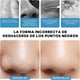 thumbnail image 4 of Medidor De Cabeza Negra De Aspiración Al Vacío, Medidor De Belleza De Limpieza De Poros, 3 Niveles De Intensidad Ajustables, Equipado Con Múltiples Cabezas De Aspiración, 4 of 7