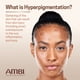 thumbnail image 3 of Crema facial Ambi Even & Clear Advanced para hiperpigmentación de 30 ml, 3 of 6