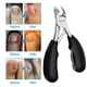 thumbnail image 2 of Cortaúñas profesional Coolmade para uñas encarnadas, gruesas y con hongos, para hombres y adultos mayores, cortaúñas para diabéticos, herramienta de podología, cortaúñas para pedicura con mango de go, 2 of 5