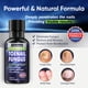 thumbnail image 2 of Tratamiento para hongos en las uñas de los pies Tobcharm Extra Fuerte 60 ml, 2 of 7