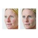 thumbnail image 3 of Crema Osmotics Blue Copper 5, reafirmante y reparadora de elasticidad, 3 of 7