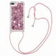 thumbnail image 1 of Funda FOXDOCK para iPhone 7 Plus/8 Plus con Cuerda Ajustable, Brillo Líquido, Protección Antigolpes y Lente – Ideal para Regalo, 1 of 6