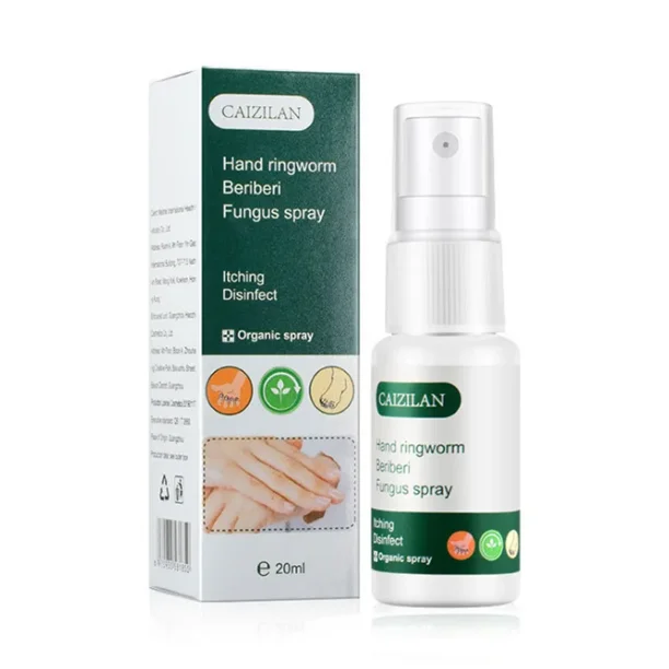 Pingworm Spray Hand Ringworm Beriberi Fungus Spray Hand and Foot Skin Care Anti Itch ...