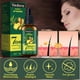 thumbnail image 2 of Sérum para el crecimiento del cabello Vedora King of Ginger 30 ml, 2 of 3