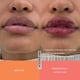 thumbnail image 5 of Bálsamo suavizante de labios EADEM Le Chouchou Lip Gloss Boba Bounce, 5 of 7