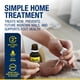 thumbnail image 3 of Kit de tratamiento para uñas encarnadas URIEL UPGRADE de 11 ml, 3 of 6