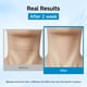 thumbnail image 4 of Mascarilla de cuello HONLINK Colágeno hidrolizado con ácido hialurónico, 8 unidades, 4 of 9