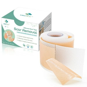 Cinta De Silicona Para Eliminar Cicatrices Yrvhck Medical Grade 180 Cm