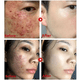 thumbnail image 2 of Green Tea Deep Cleansing Facial Mask Stick Pore Cleaner For Face Purifying Clay Blackhead Remover Skin Care Beauty Health, 2 of 3