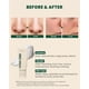thumbnail image 3 of Espuma limpiadora K-SECRET SEOUL 1988 Pine Cica 1% + Probiotics 150 ml, 3 of 3