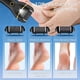thumbnail image 3 of Kit eléctrico para eliminar callos en los pies Jamestry, impermeable, 17 en 1, 3 of 7