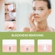 thumbnail image 5 of Mascarilla removedora de puntos negros LANBENA Remove 30 ml, 5 of 8