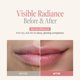 thumbnail image 5 of Bálsamo labial ANILLO 5 g Rose Glow Rubor con tono coreano, 5 of 9