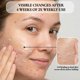 thumbnail image 3 of Gel Exfoliante Facial Vivo Per Lei 120 ml Suave, 3 of 9