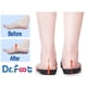 thumbnail image 3 of Plantillas Ortopédicas Dr Foot 3/4 de Largo con Soporte de Arco XS, 3 of 6