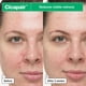 thumbnail image 3 of Crema en gel Dr.Jart+ Cicapair So Soothing 30 ml para piel irritada, 3 of 6