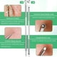 thumbnail image 4 of Kit de 5 piezas para extraer puntos negros y comedones de acero inoxidable, 4 of 9