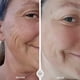 thumbnail image 5 of Herramienta de estiramiento facial 5 en 1 OMG Blaster de Ashley Black, 5 of 8