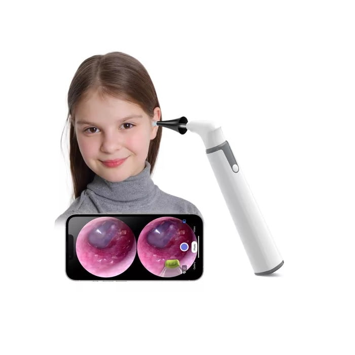 Masterprox - Otoscopio Inalámbrico Wifi Con Cámara De Oído Luz Led