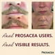 thumbnail image 2 of Prosacea - Cura la rosácea Síntomas de enrojecimiento, espinillas, 2 of 2