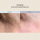thumbnail image 2 of Suero Facial Aloisia Beauty 50 ml – Niacinamida, 2 of 6