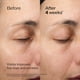 thumbnail image 4 of Crema Shiseido Future Solution LX para ojos y labios 17 ml, 4 of 9