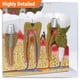 thumbnail image 2 of Modelo Anatómico GPI Anatomicals Dientes Humanos Problemas Dentales, 2 of 7