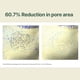 thumbnail image 3 of Set Skincare Pyunkang Yul Calming Tea Tree acido Hialuranico, 3 of 3