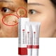thumbnail image 1 of Crema Fupah Blanqueadora 20g Eliminacian Manchas y Acna, 1 of 3