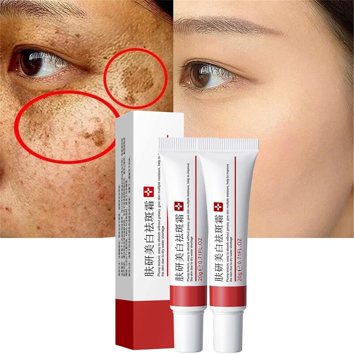 Crema Fupah Blanqueadora 20g Eliminacian Manchas Y Acna