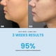 thumbnail image 3 of Masajeador facial y de cuello con luz LED LiftLab Skin Sculptor, 3 of 8